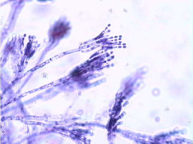 penicillium conidia